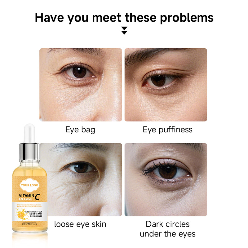 Private Label Natural Vc Eye Serum for Dark Circles, Fine Lines Puffiness CrowS Feet Eye Bags Under Eyes(pic4)