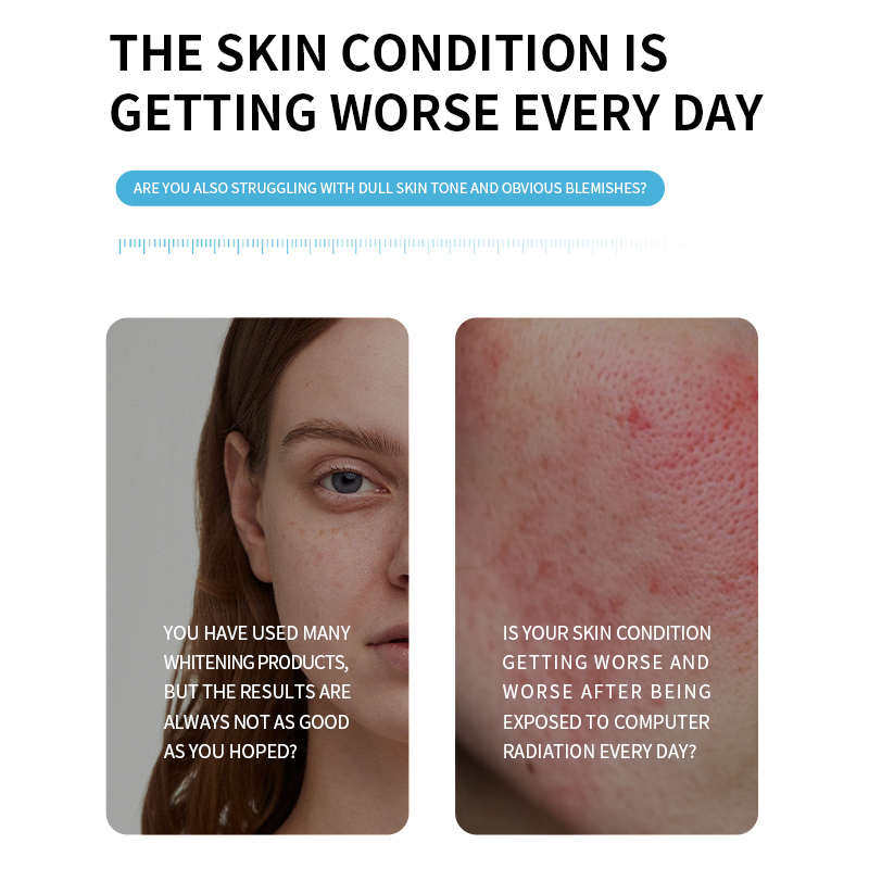 Niacinamide Brightening 3% Vitamin B3 Liquid Face Spray Whitening Serum Mist Dark Spot Correction Hydration OEM Cosmetic Bulk(pic3)