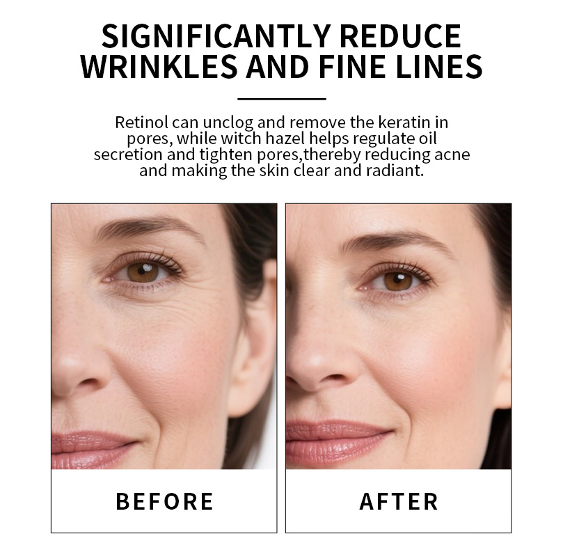 Private Label 30ML Dark Spot Remover Firming Skin Anti Wrinkles Anti Aging Moisturizing Retinol Serum(pic1)