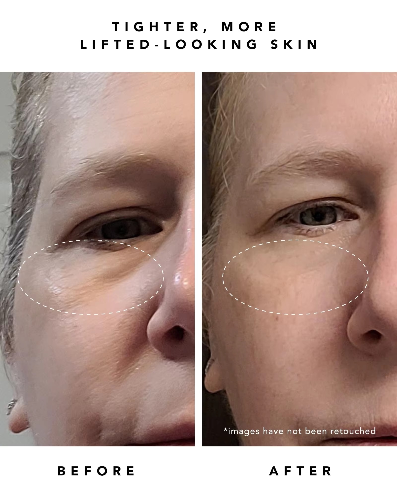 Private Label 30ML Dark Spot Remover Firming Skin Anti Wrinkles Anti Aging Moisturizing Retinol Serum(pic7)