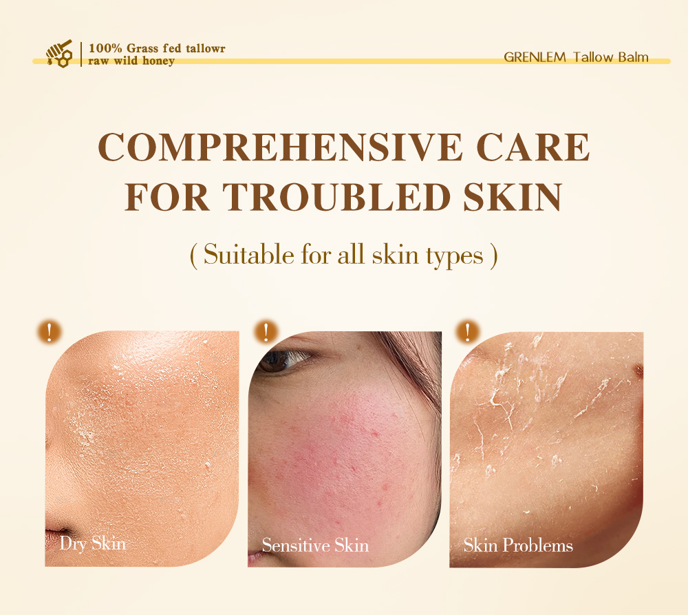 Greenlem TALLOW BALM Natural Beef Fat,Gently Nourishing(pic1)