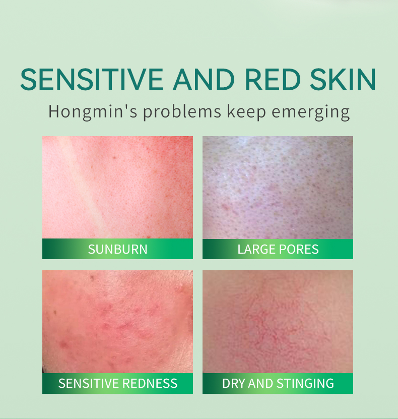 Icesea Centella Asiatica Serum 30ml Calming Soothing Redness Relief Acne Prone Skin OEM Wholesale(pic2)