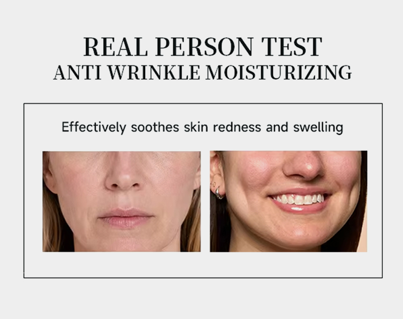 OEM ODM 147 Barrier Cream Ceramide NP Avocado Hyaluronic Acid Deep Hydrating Barrier Repair Moisturizing Facial Cream(pic2)