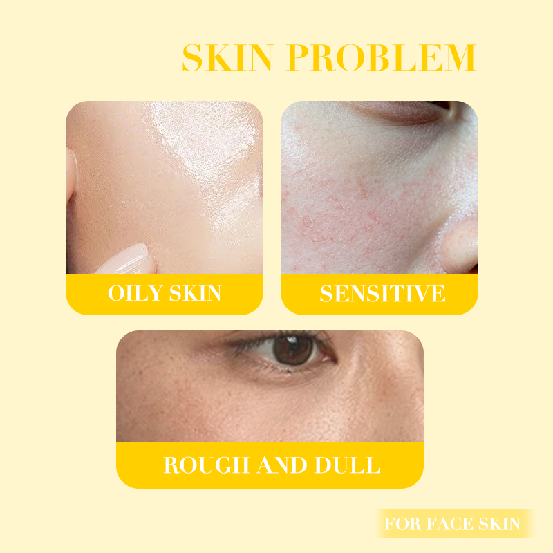 Icesea OEM Pineapple De-Pigmentation Serum, Brightening Face Serum with Alpha Arbutin & Niacinamide(pic2)
