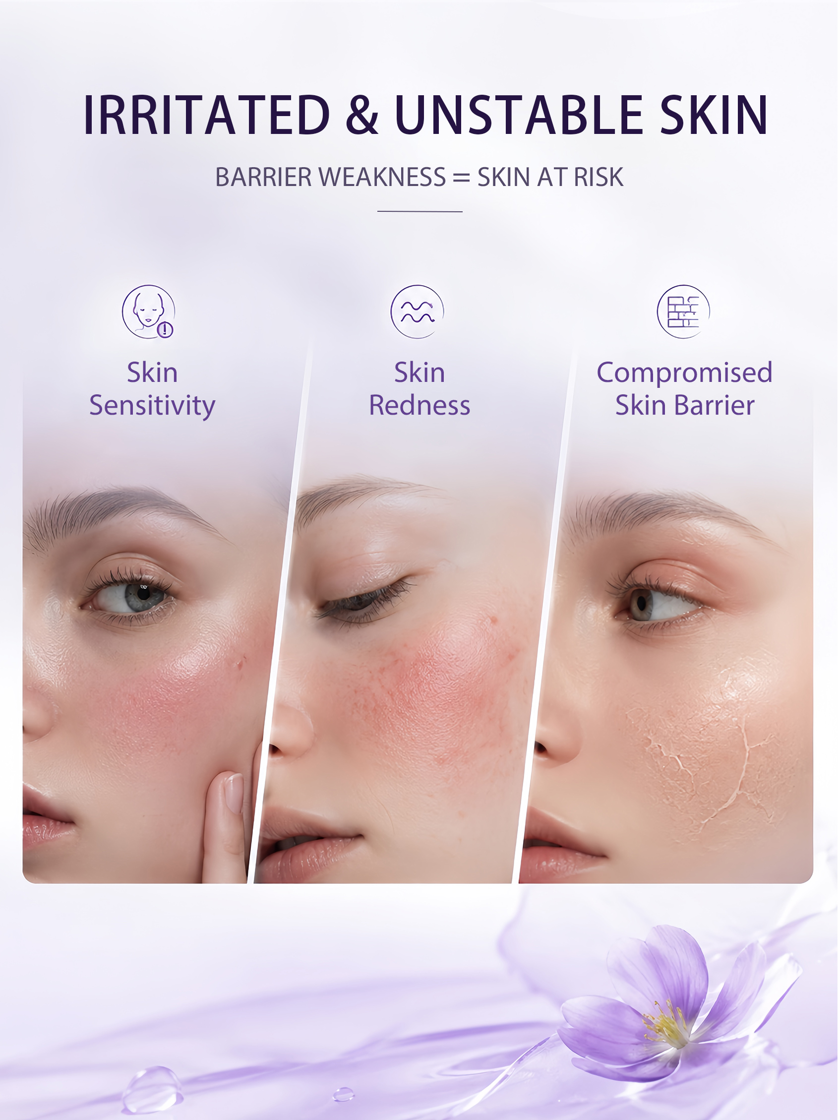 OEM ODM Lavender Ceramide Barrier Repair Serum Gentle Soothing Relieve Facial Redness Hydrating Sensitive Skin Facial Essence(pic2)