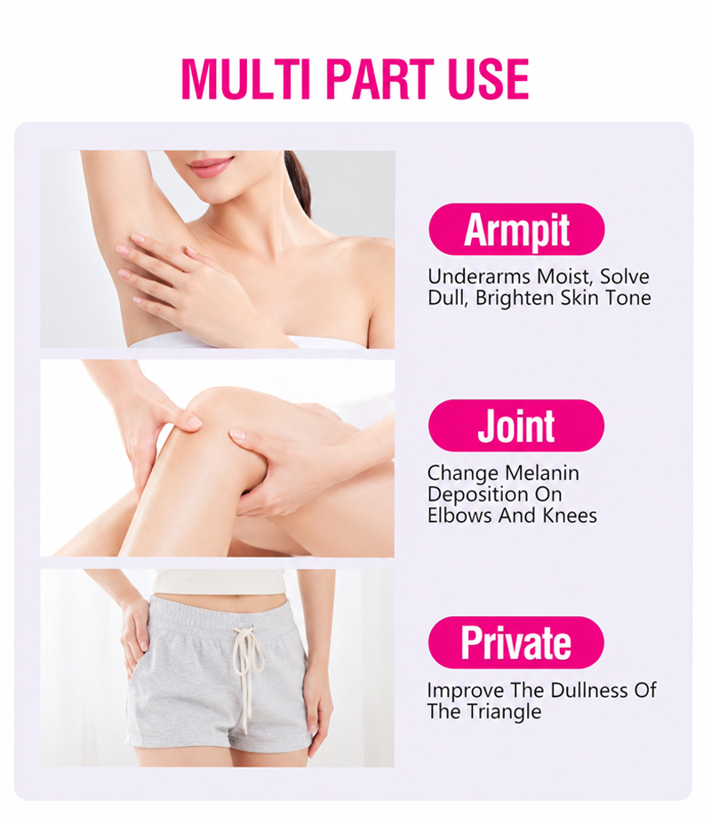 Private Label Niacinamide Milk Brightening Cream for Dark Underarms Inner Thighs Intimate Areas OEM(pic2)